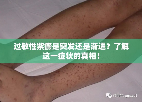 过敏性紫癜是突发还是渐进?了解这一症状的真相!